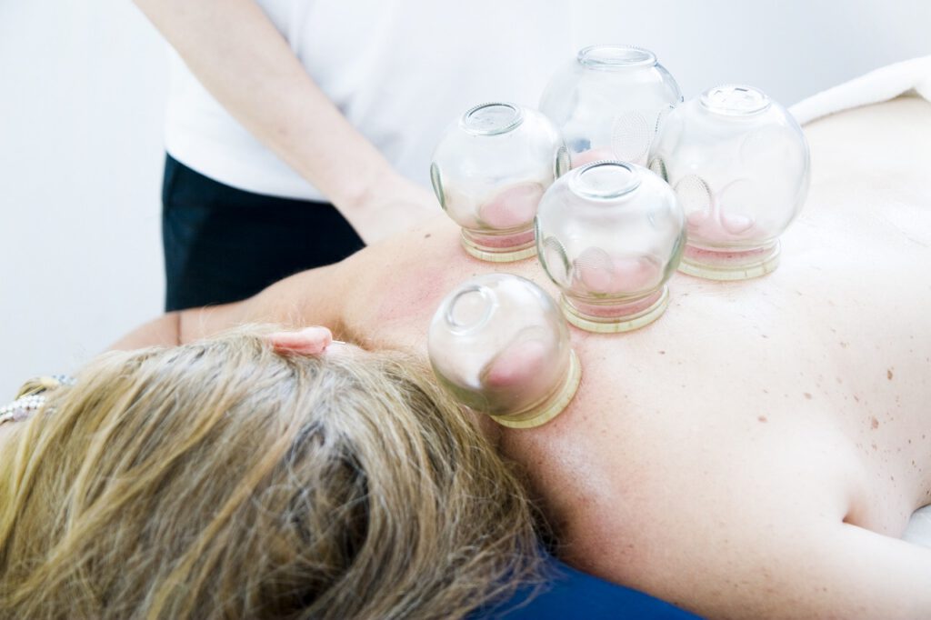 cupping therapy 6604217 1280